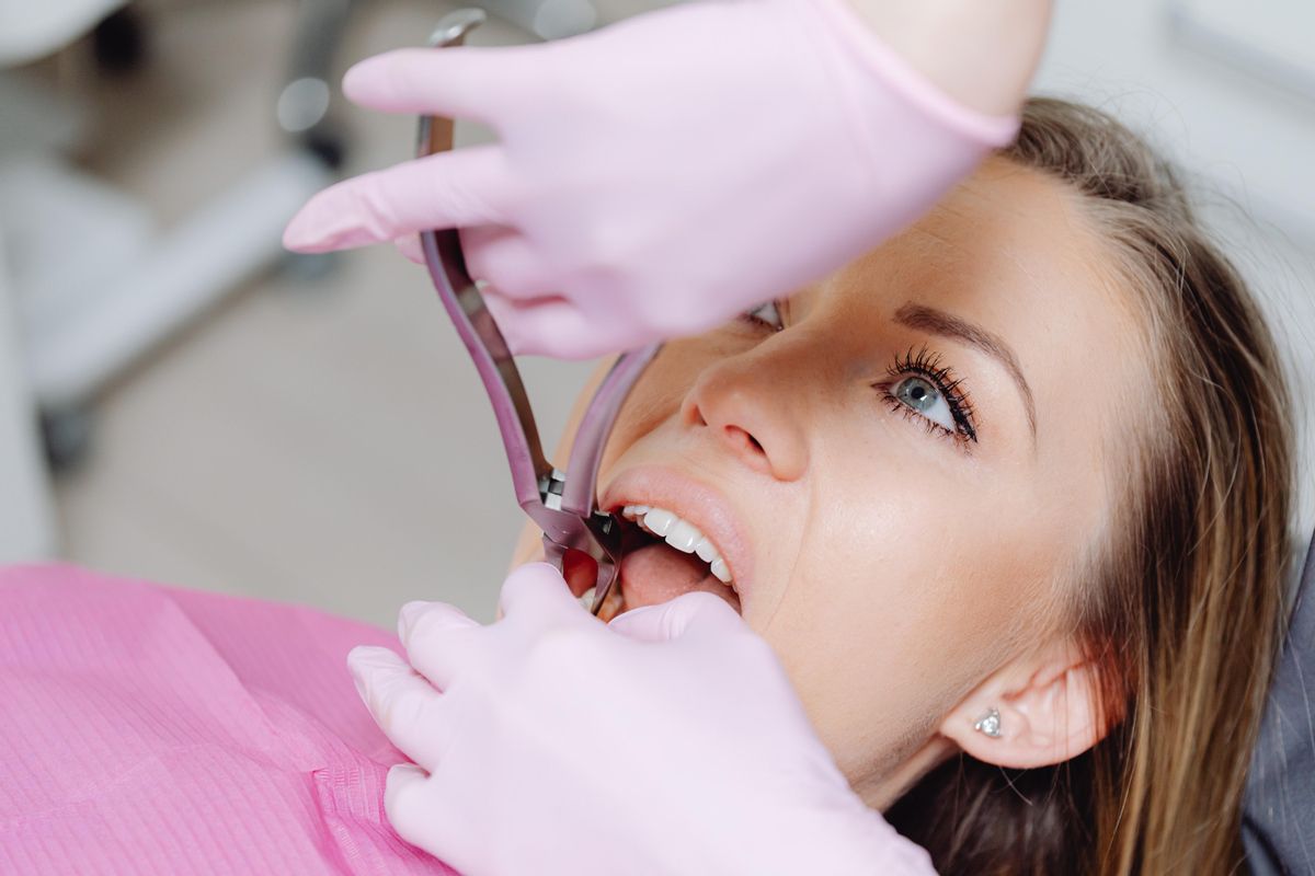 Agenesia dental: qué es, cómo se trata y qué problema graves puede provocar Agenesia dental: qué es, cómo se trata y qué problema graves puede provocar