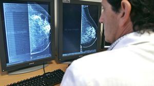 Un médico consulta una mamografía.