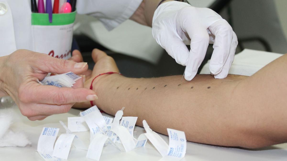 Un paciente se somete a una prueba de alergia en el Hospital Virgen de la Arrixaca de Murcia.