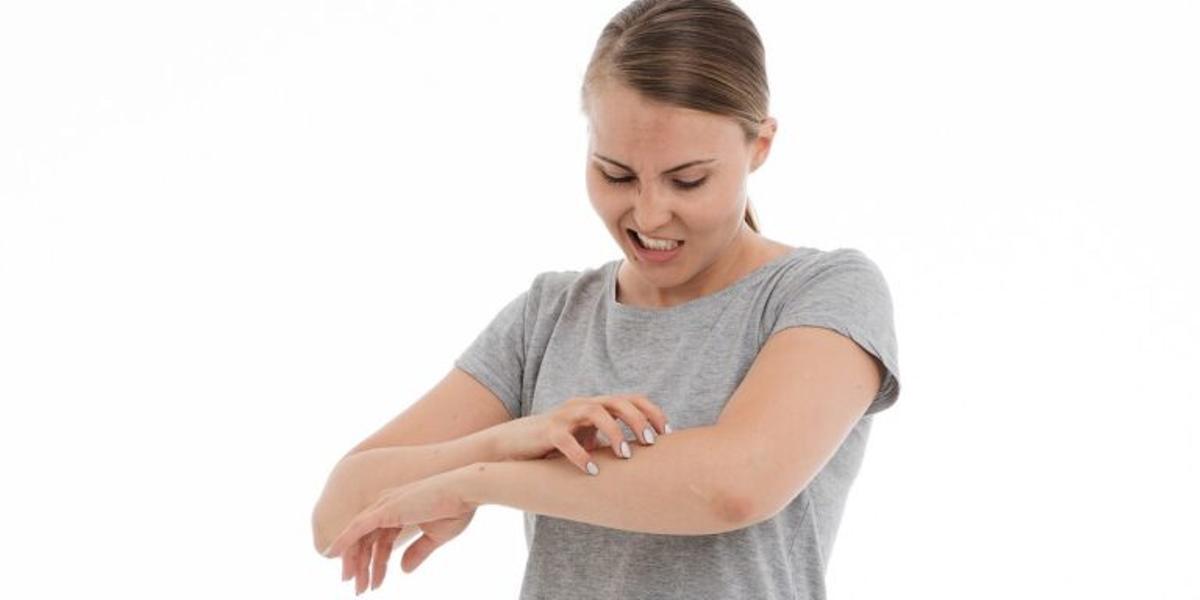 Qué es la dermatitis atópica y 11 recomendaciones para evitar el desesperante picor