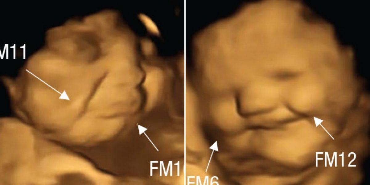 Los bebés reaccionan al gusto desde el útero: sonríen ante la zanahoria y lloran ante la col rizada