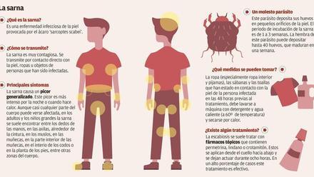 Enfermedades Sarna una epidemia permanente en la Región de Murcia El Periódico de España