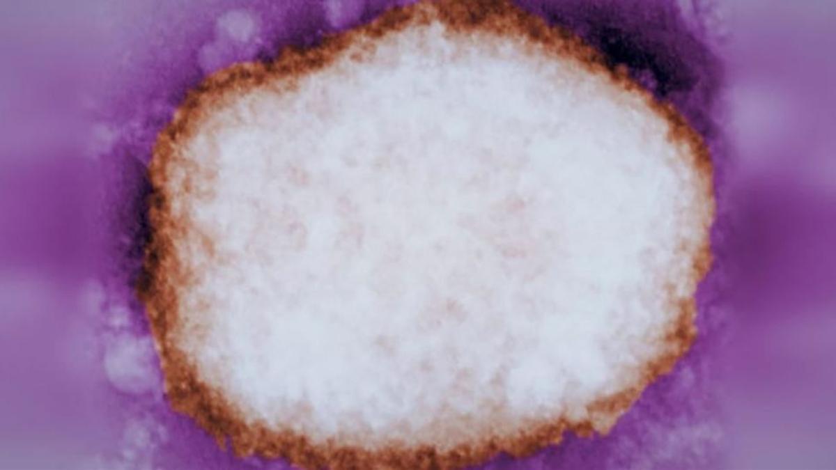 Partícula amplificada del virus de la viruela del mono. CDC