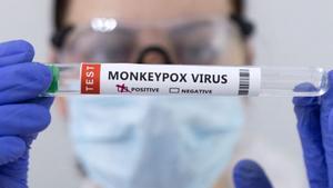 Una sanitaria muestra un test positivo de viruela del mono.