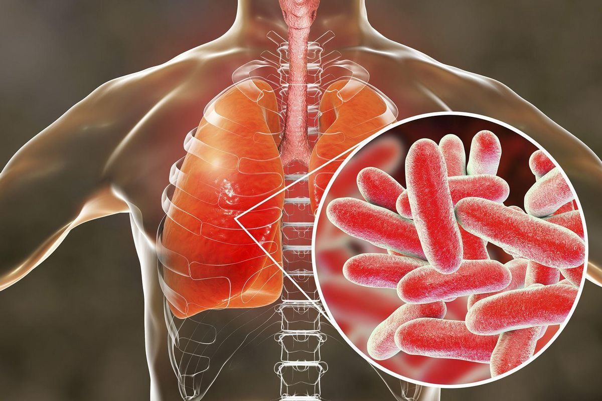 Cómo prevenir la infección por legionela que ha provocado dos muertes en Cáceres Cómo prevenir la infección por legionela que ha provocado dos muertes en Cáceres