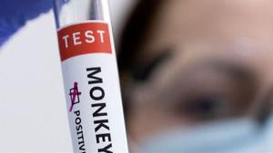 Un test de la viruela del mono.