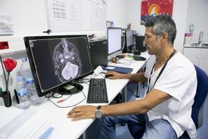 Unidad de ictus del Hospital Vall d’Hebron