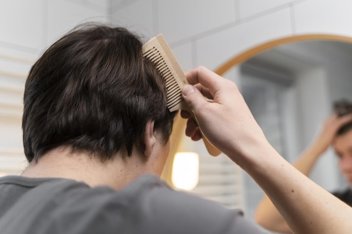 La caspa es un problema común del cuero cabelludo que afecta a muchas personas en todo el mundo.