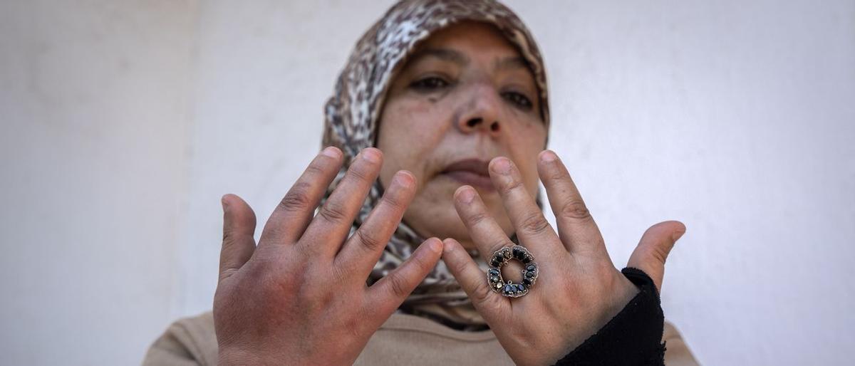 Malika Ouchitachen muestra sus manos hinchadas tras 25 años de trabajo doméstico