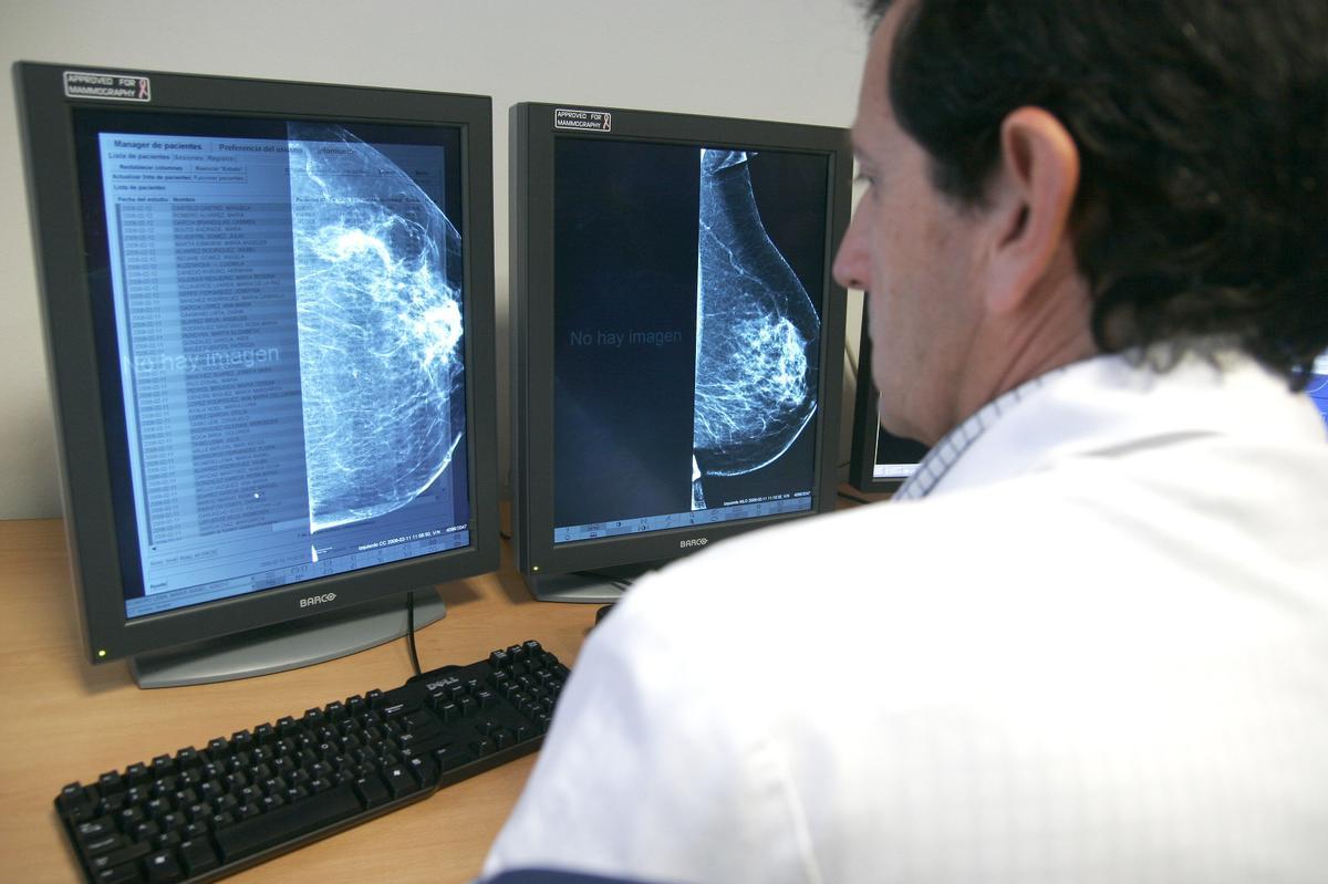Un médico, junto a un mamógrafo digital.