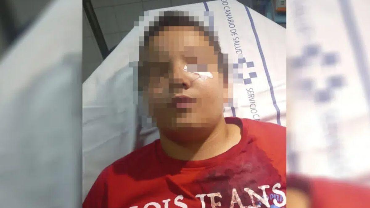 Un niño de 11 años de Canarias, hospitalizado tras defender a su abuelo de unos agresores