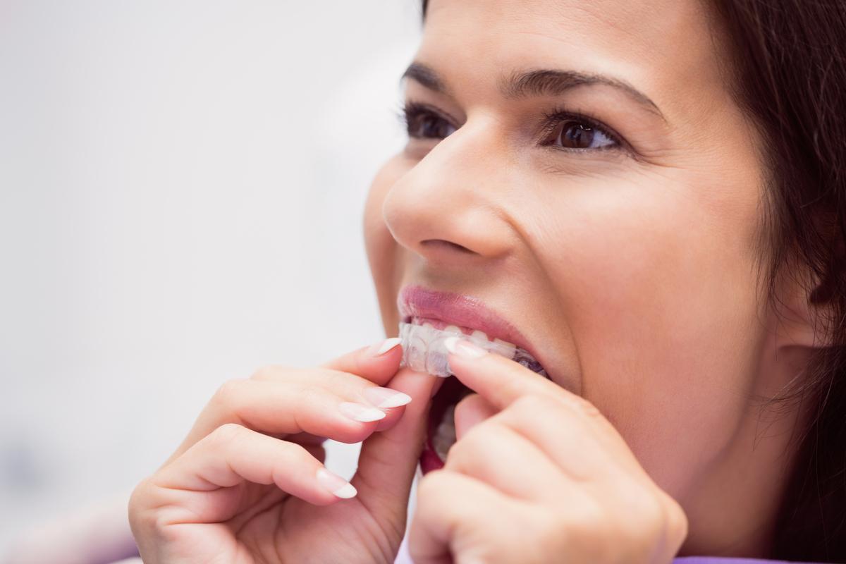 Los odontólogos avisan: el uso de alineadores sin prescripción causan problemas en el oído